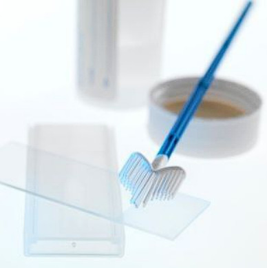 analizy ginecolog мазок на цитологію й флору