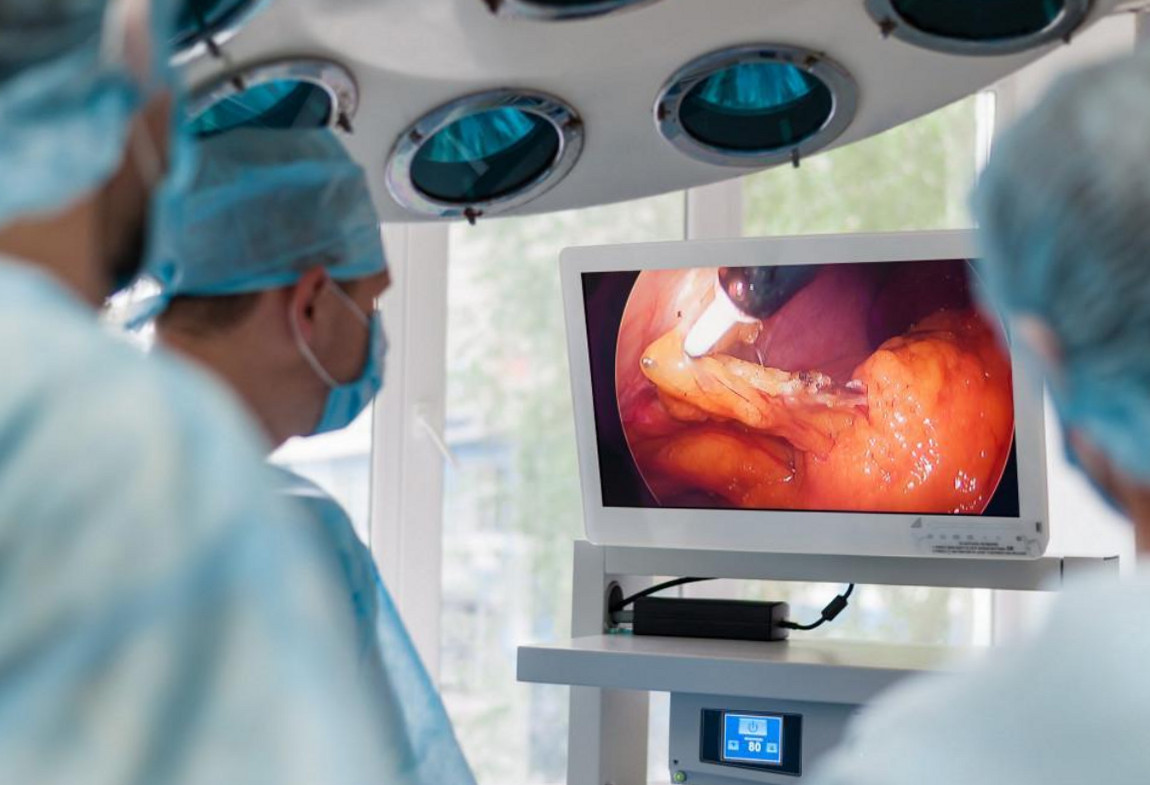 Лапароскопія akusher ginekolog com ua