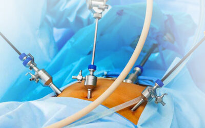 Лапароскопія в гінекології