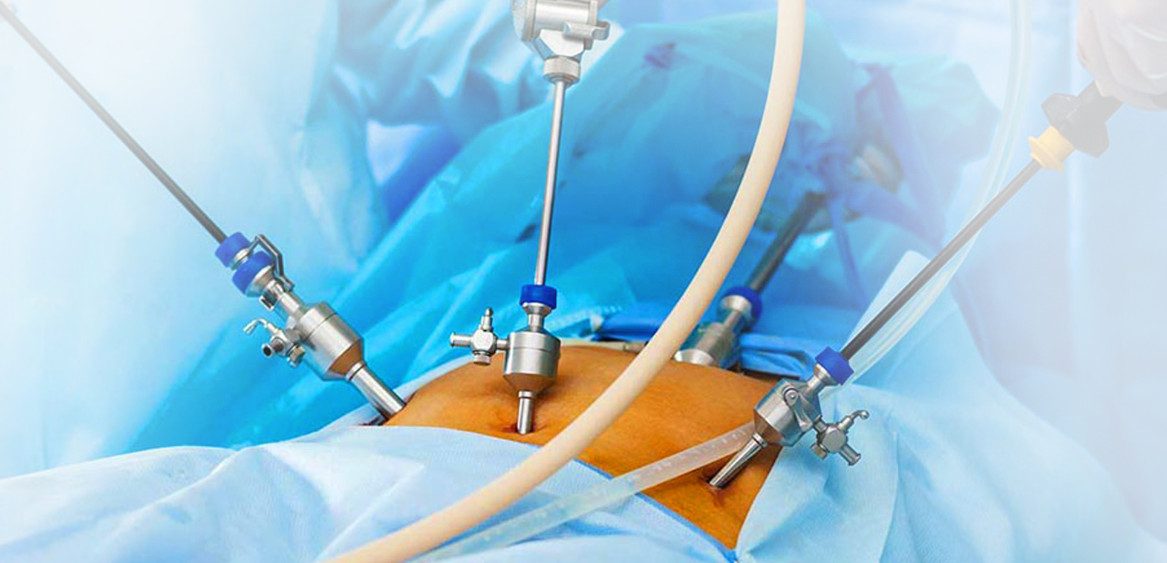 Лапароскопія фото приклад akusher ginekolog com ua