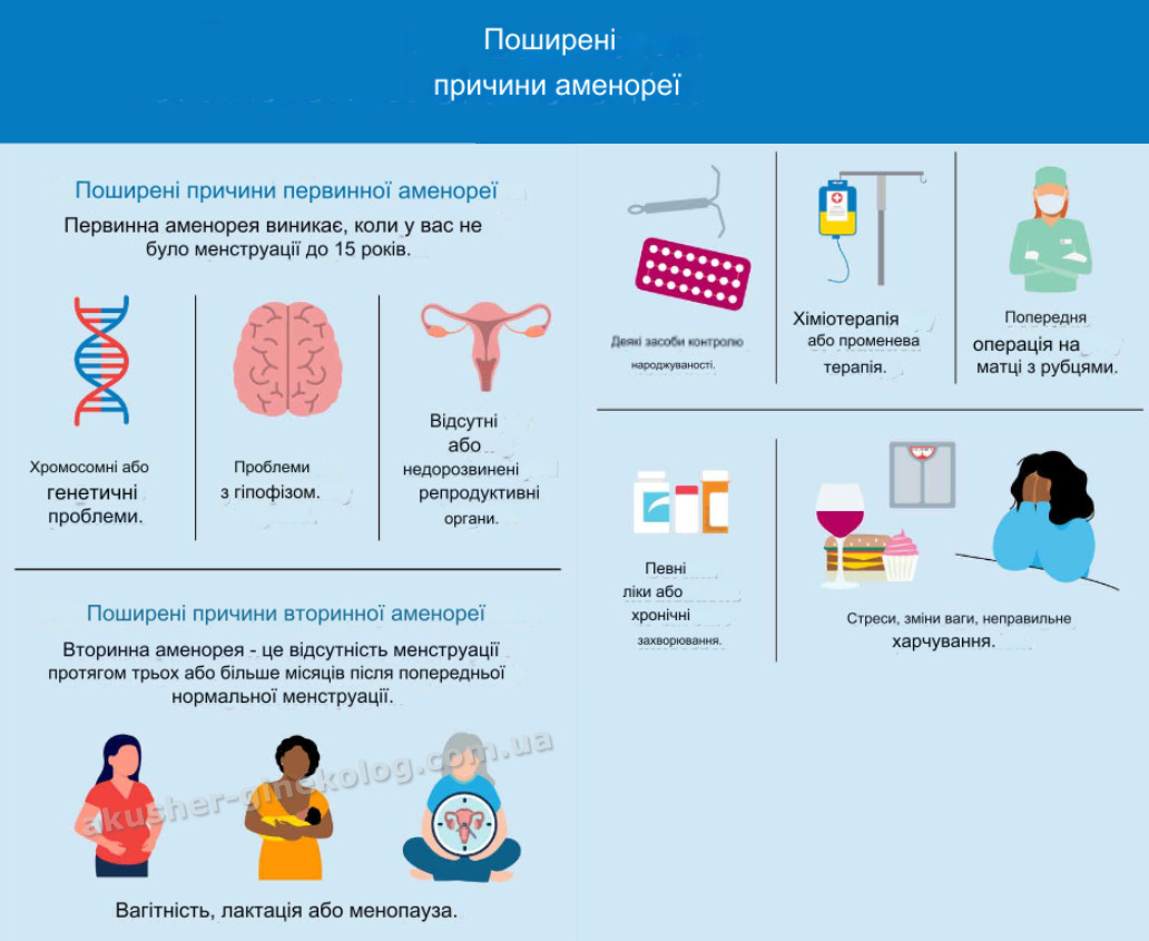 аменорея infografika akusher ginekolog com ua