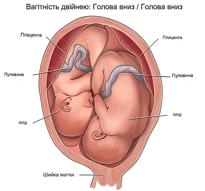 багатоплідна вагітність інфографіка
