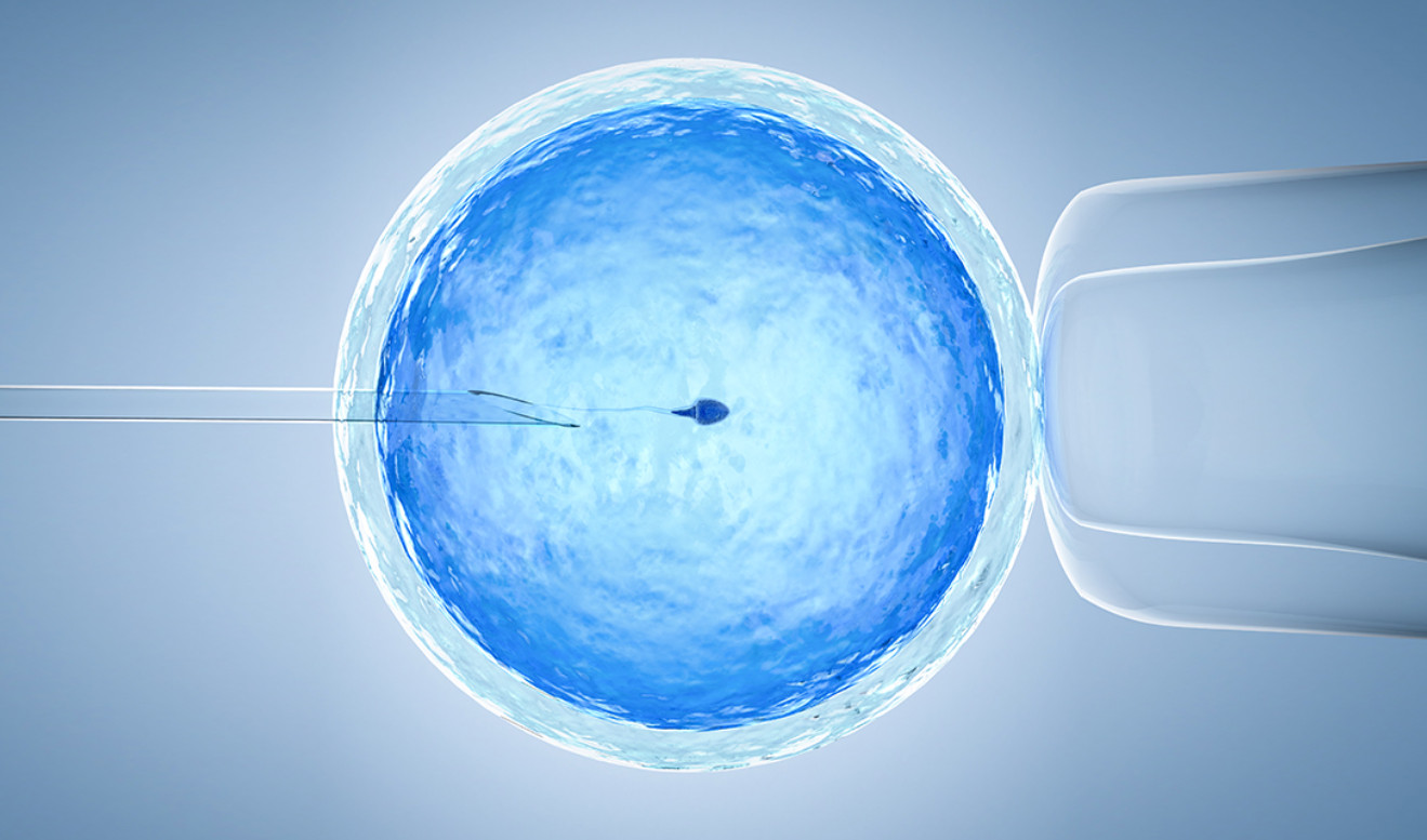 інтракорпоральне запліднення (ЕКЗ) akusher ginekolog com ua