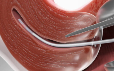 Біопсія шийки матки