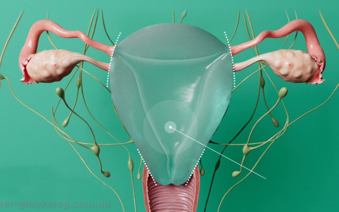 Гістеректомія: що варто знати про операцію