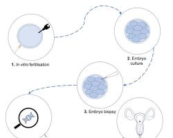Зображення: ПГД процедура